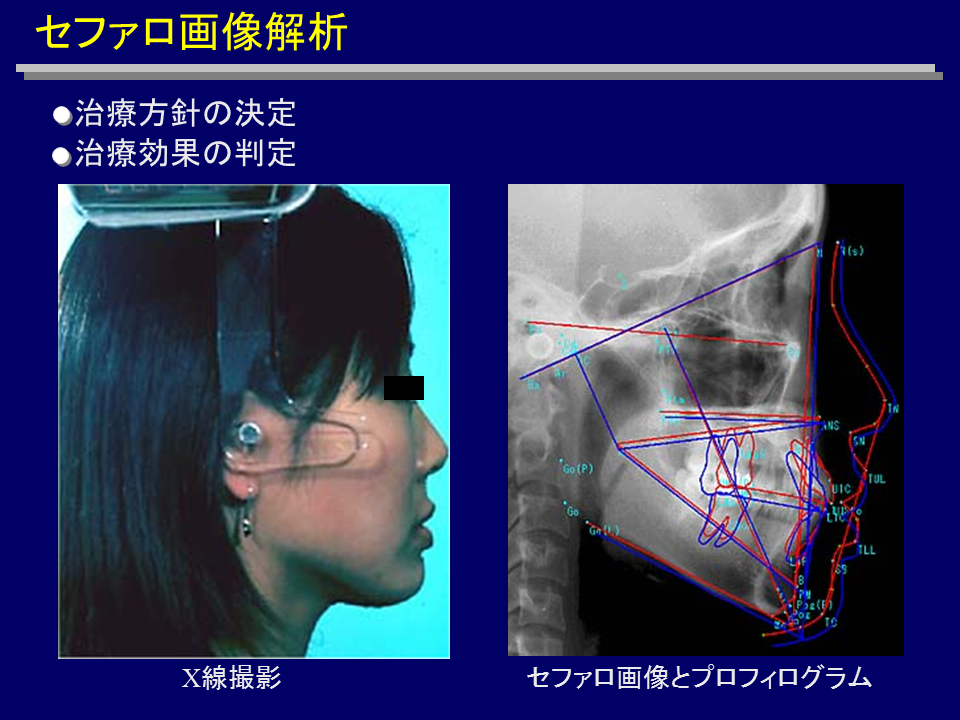 Zt@摜